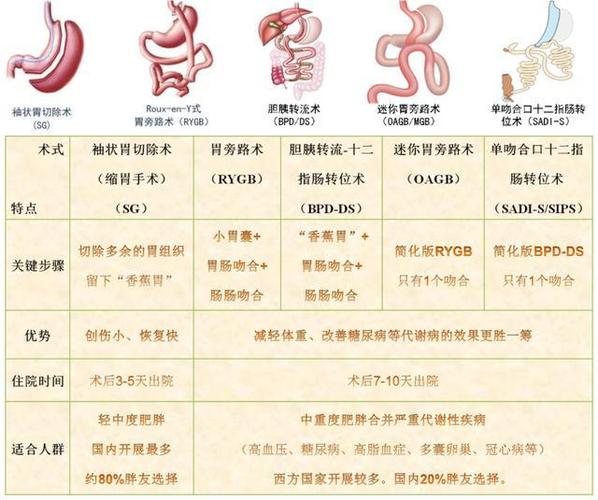 最新减肥手术