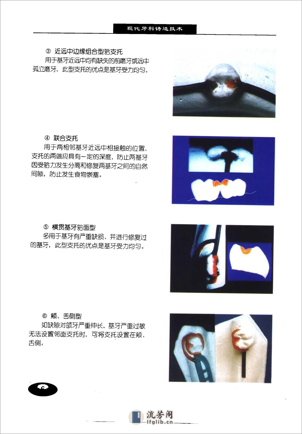 最新义齿技术引领口腔医疗新时代革新